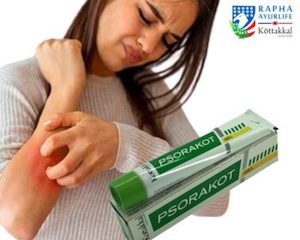 Kottakkal Psorakot- Skin Problems 50g