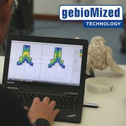 Gebiomized: GebioMized Software Pre-Fit Software