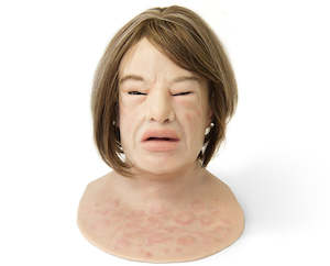 Cosmetic: Erica Anaphylaxis SimMan Facial Overlay