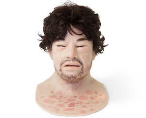 Cosmetic: Eduardo Anaphylaxis SimMan Facial Overlay