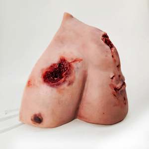 Cosmetic: MT830 Trauma Wound Packing Shoulder