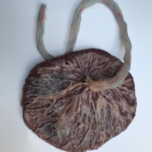 Full term Placenta And Umbilical Cord