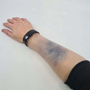 MR051 Bruise Sleeve