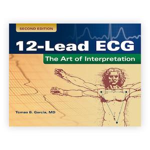 12-Lead ECG : The Art of Interpretation