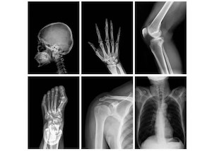 Human X-Rays 6PCS