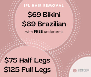 Up to 50% off IPL Hair Removal - Selected Areas