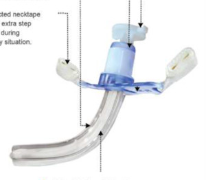 Tracheostomy Tube - Uncuff