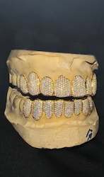 Custom VVS Grillz