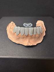 Custom VVS Grillz 8 Bottom