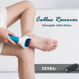 Rechargeable Foot Pedicure Tools Callus Remover-CD575 - INKPOWER NZ