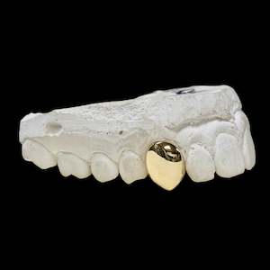 One tooth in 9kt Gold