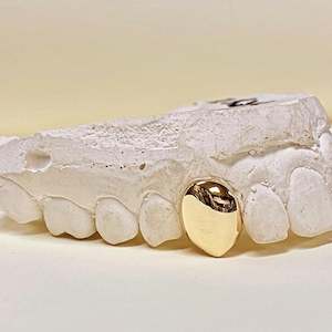 Custom Made Grillz-Single tooth capped in solid 9kt Gold