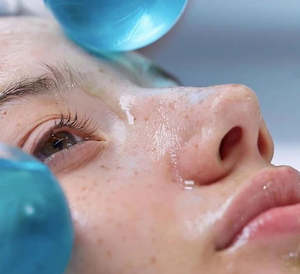 Fire and Ice Facial