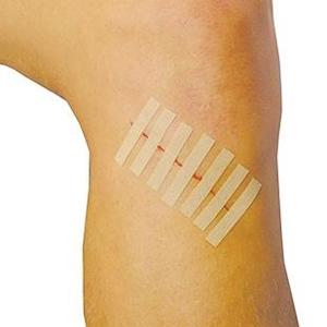 Steri Strips