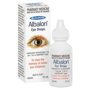 Chemist shop - pharmacy: Albalon Eye Drops 15ml