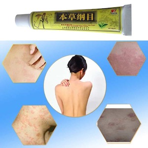 QICAOGANGMU Focallure Skin Psoriasis Cream 15g tube - Online Health