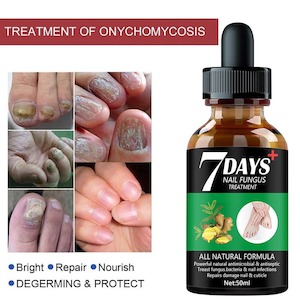 Nail Fungus Treatment 50mls - Online Health