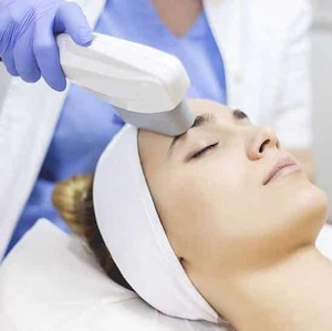 IPL Collagen Stimulation Facial – Wellington – 1 person