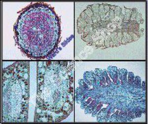 Pine Life History (cs) Root stem and leaf. (ls) Male and female cones QS