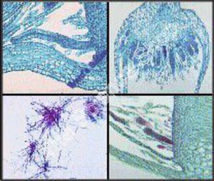 Moss Life History (wm) protonema (ls) Antheridia archegonia and sporophyte QS