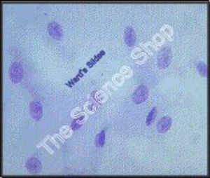 Barr Bodies (sm) CV Cheek cells of normal human male and female Shows absence of…