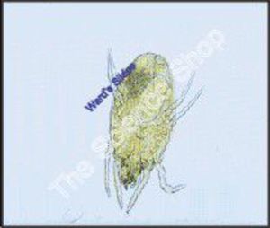 Dust Mite Dermatophagoides (wm)