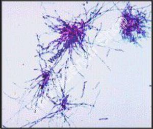 Mnium Protonema (wm) FS and FG