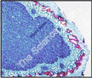 Root Nodules, Legume Bacteria Slide