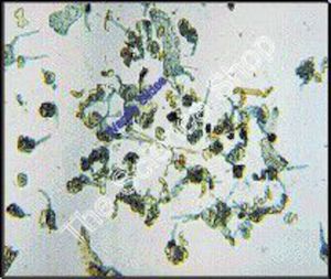 Fern Filamentous Prothalli (wm) Showing germinating spores FS and FG