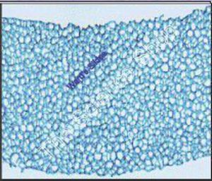 Hydrodictyon (wm) Nets of multinucleate cel(ls) Unwanted Invader of New Zealand's Lakes