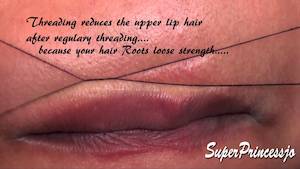 Threading of the Lip or Chin