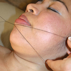 Threading of the Lip and Chin