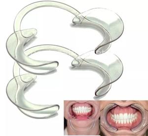 C-Shape Dental Mouth Opener